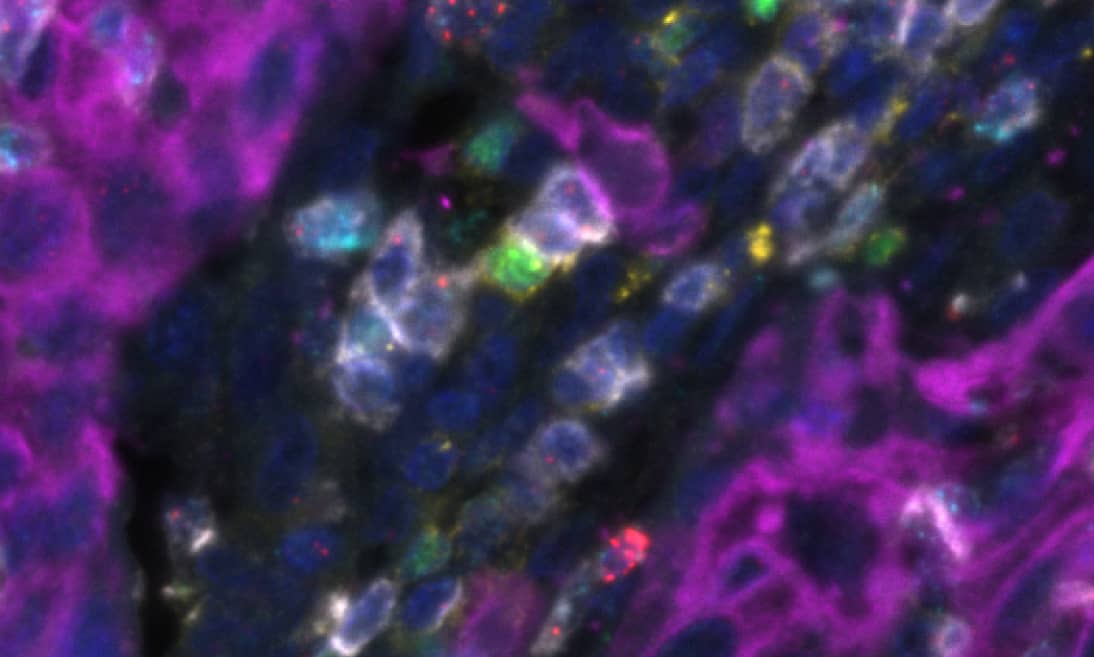 Protein and RNA on the Same Section: True Multiomics