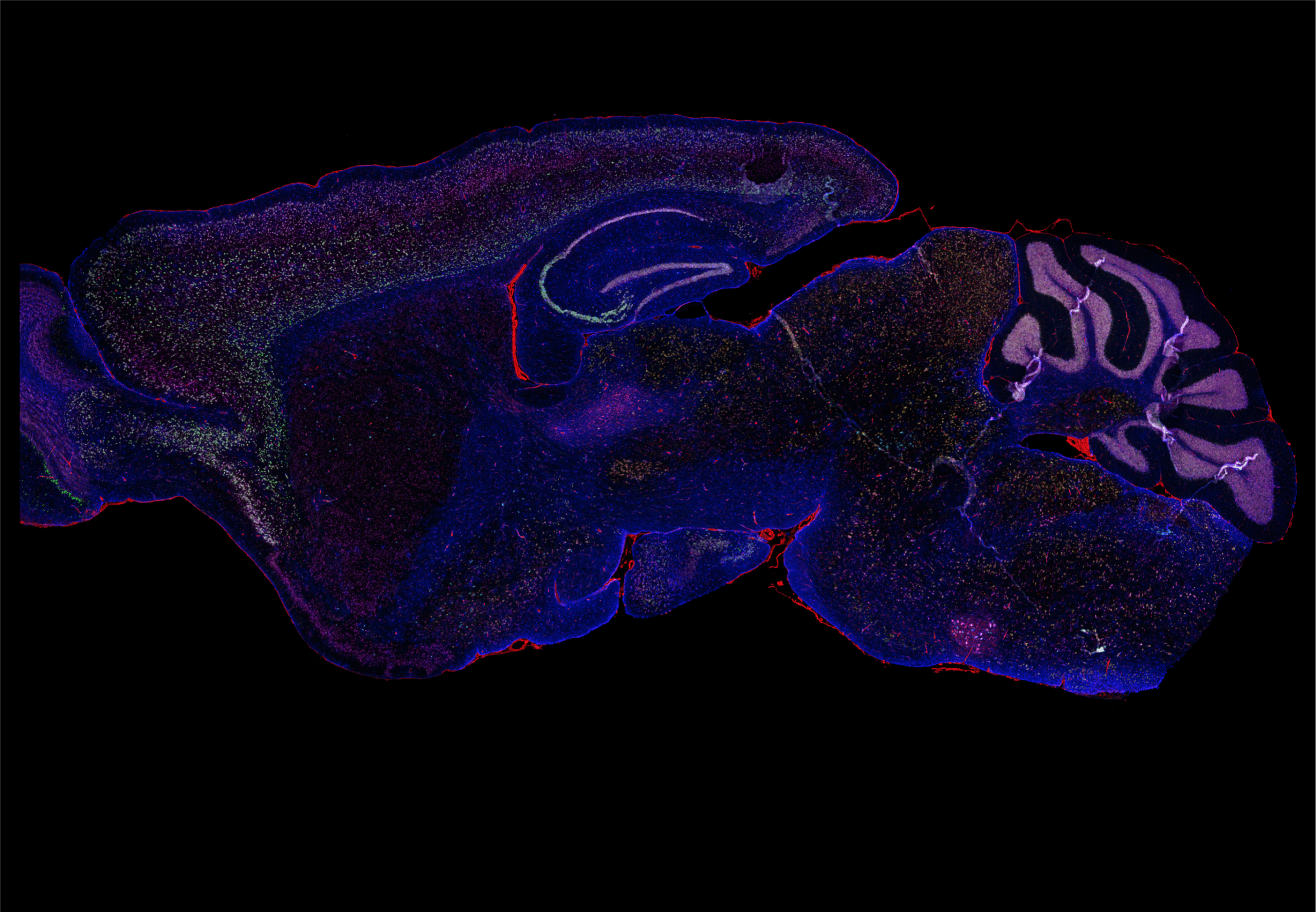 Section of whole mouse brain, Amyotrophic Lateral Sclerosis (ALS), FS tissue Slc17a7 (green) Chat (turquoise) Slc17a6 (yellow) NeuN (pink) GFAP (blue) TSPO (red)