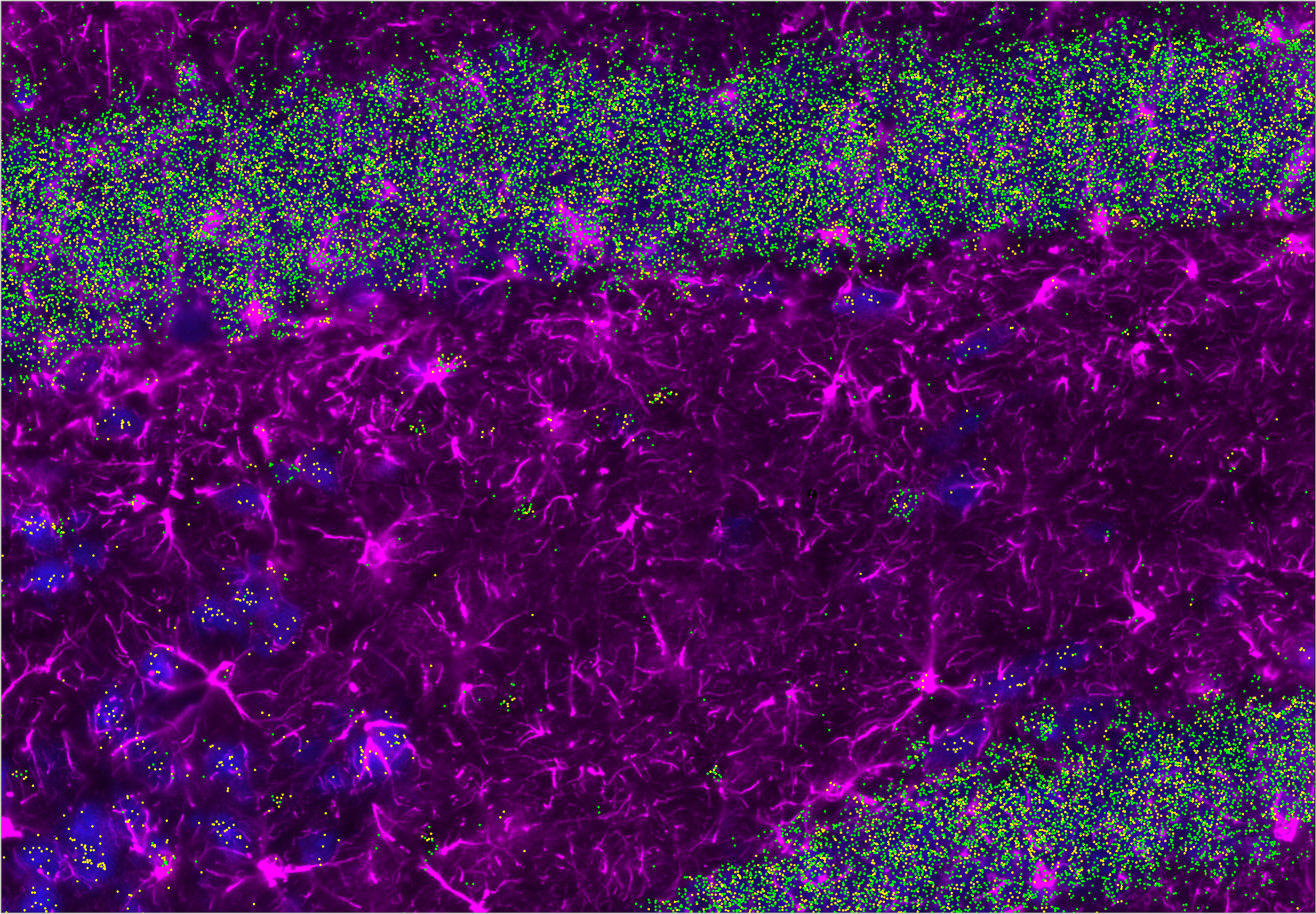 Mouse brain, hippocampus, Amyotrophic Lateral Sclerosis (ALS), FS tissue. Dot mask is generated with HORIZON™ Rbfox3 (yellow) Prox1(green) NeuN (blue) GFAP (pink)