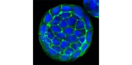 ICC/IF staining of E-Cadherin protein in cultured human colon cancer spheres using NBP2-19051 with DyLight 488 conjugated secondary antibody (green). The nuclei of the cells were counterstained using DAPI (blue).