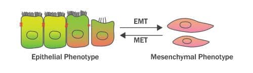 A quick illustration of the EMT pathway