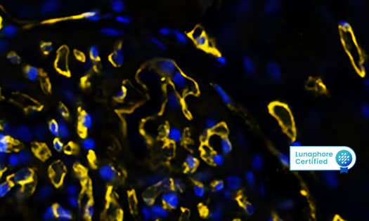 Detection of CD4 in Human Tonsil via Multiplex Immunofluorescence (mIF) staining on COMET™"