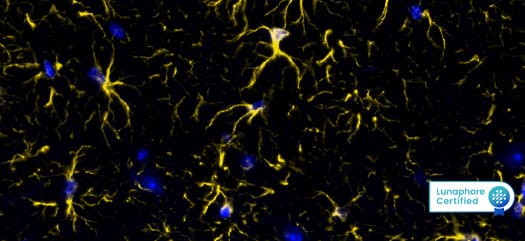 Feature 1 GFAP image 