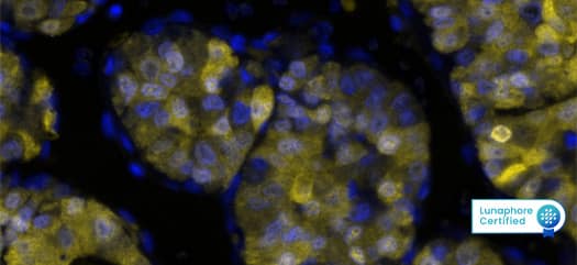 Feature 3- Arg1 image 