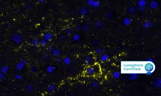 Detection of AQP4 in Human Brain Cortex Data Image