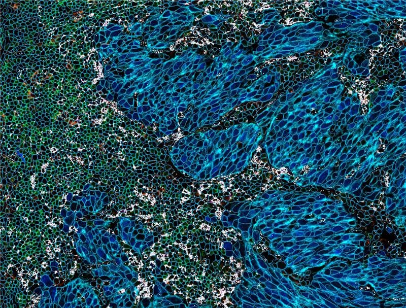 RNAscope Multiomic - All Markers - COMET