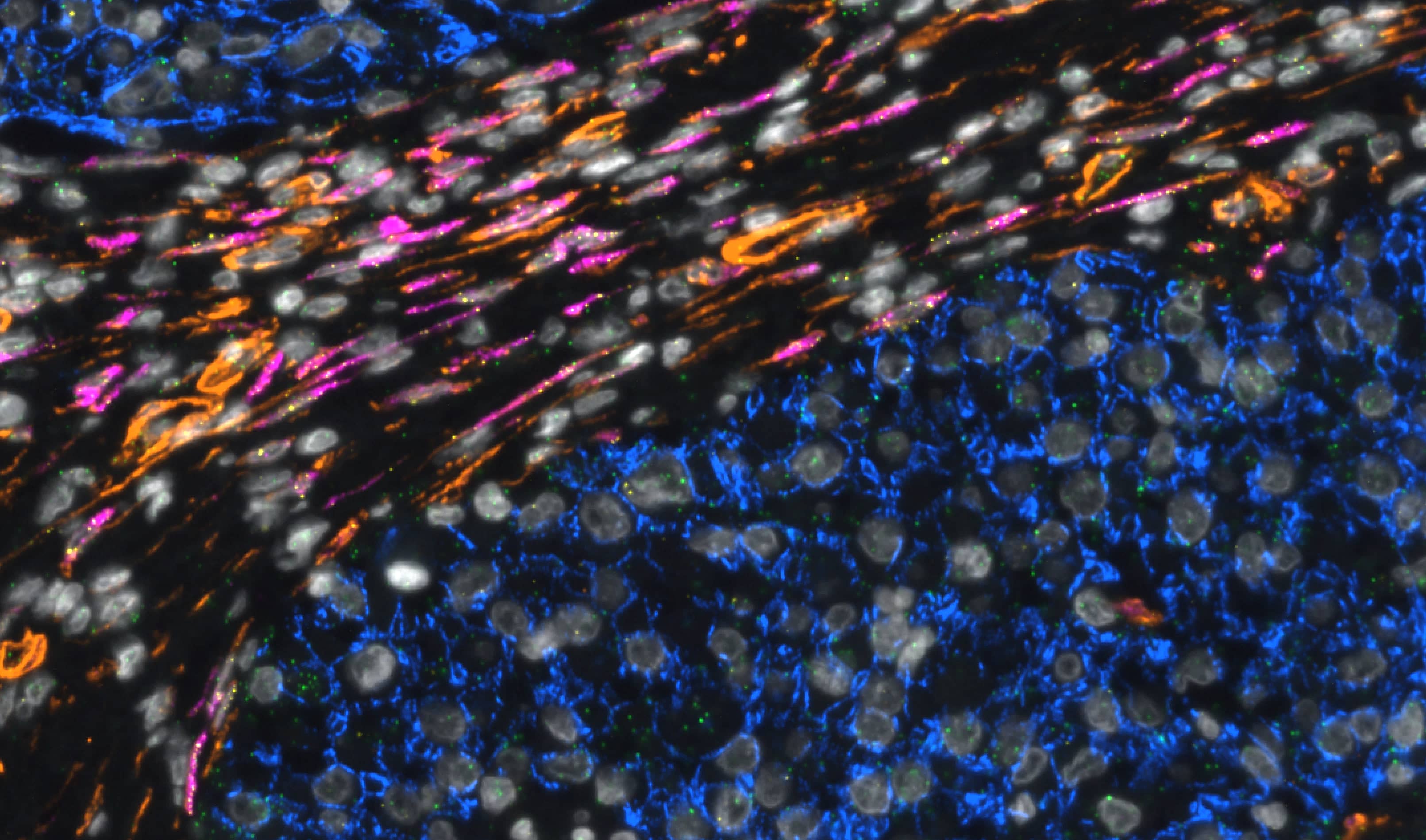RNAscope Multiomic Melanoma COMET 2