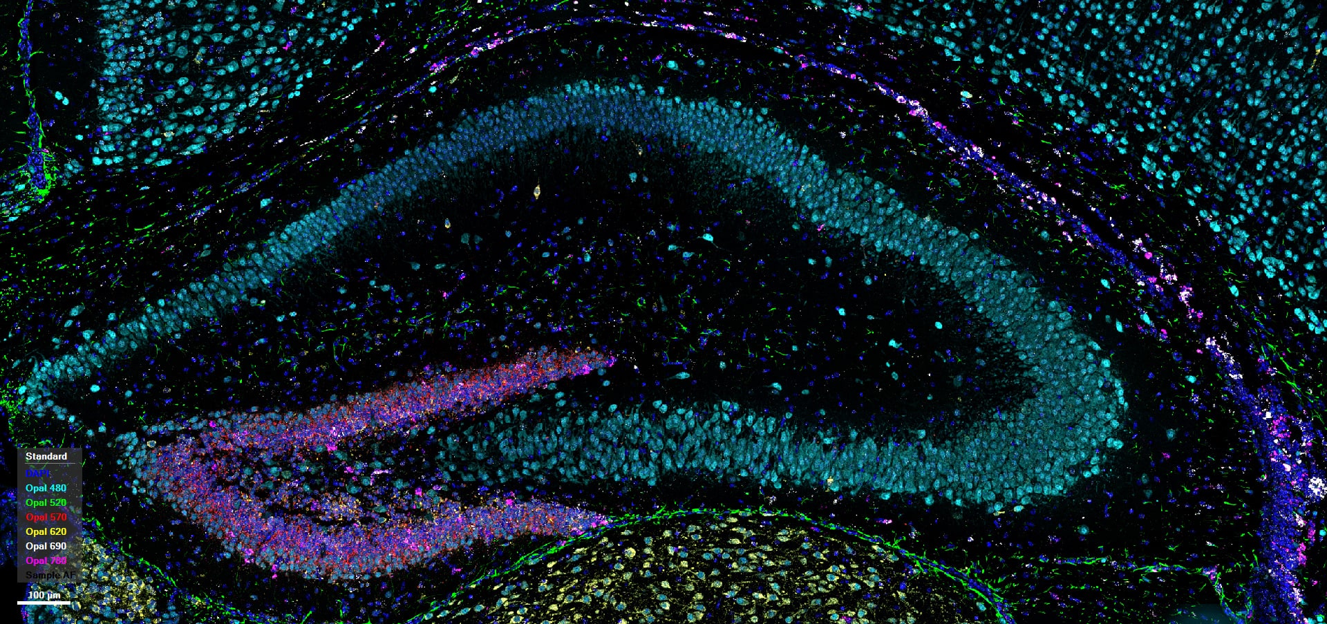 Assess neurogenesis (progenitor stem cells) in mouse brain. Simultaneous detection of a panel of 2 Proteins (NeuN, GFAP) and 4 target RNA (Prox1, Ascl1, Calb2, Top2a) and in FFPE mouse brain hippocampal tissue. Nuclei were stained with DAPI.