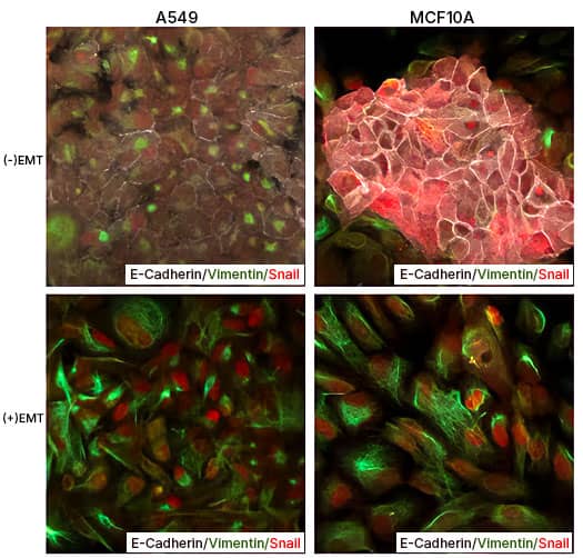 EMT Induction in A549 and MCF 10A cells with StemXVivo EMT Inducing Media Supplement (100X)