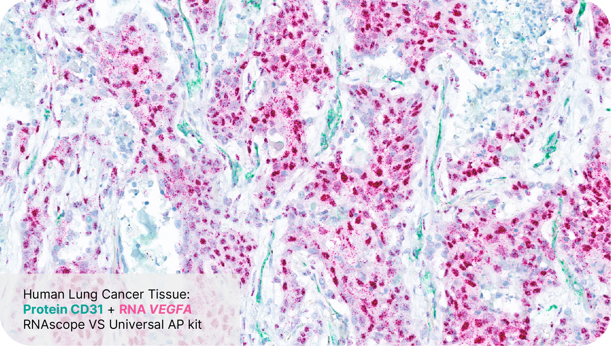 Protein CD31 + RNA VEGFA - RNAscope VS Universal AP Assay