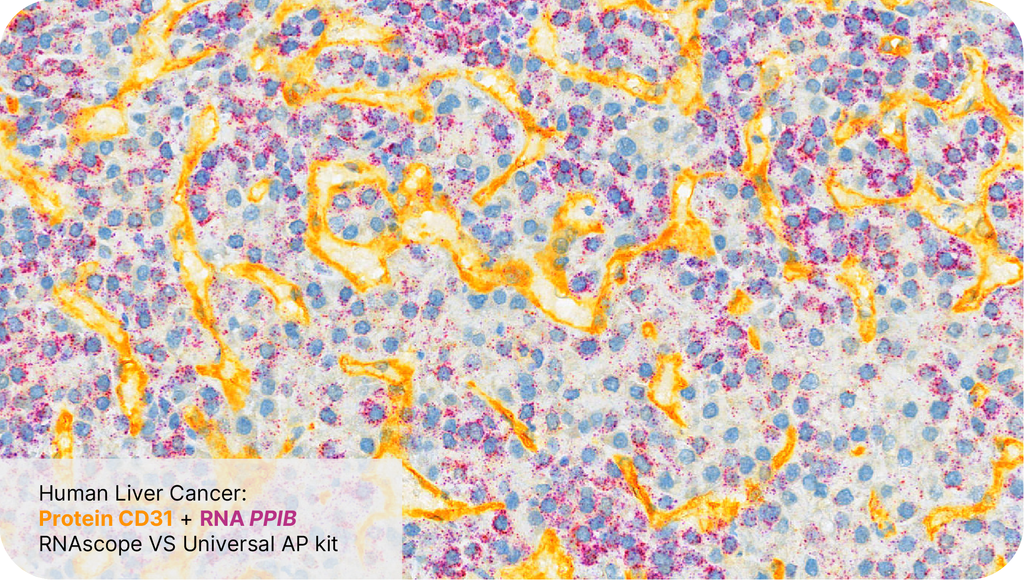 Protein CD31 + RNA PPIB - RNAscope VS Universal AP Assay