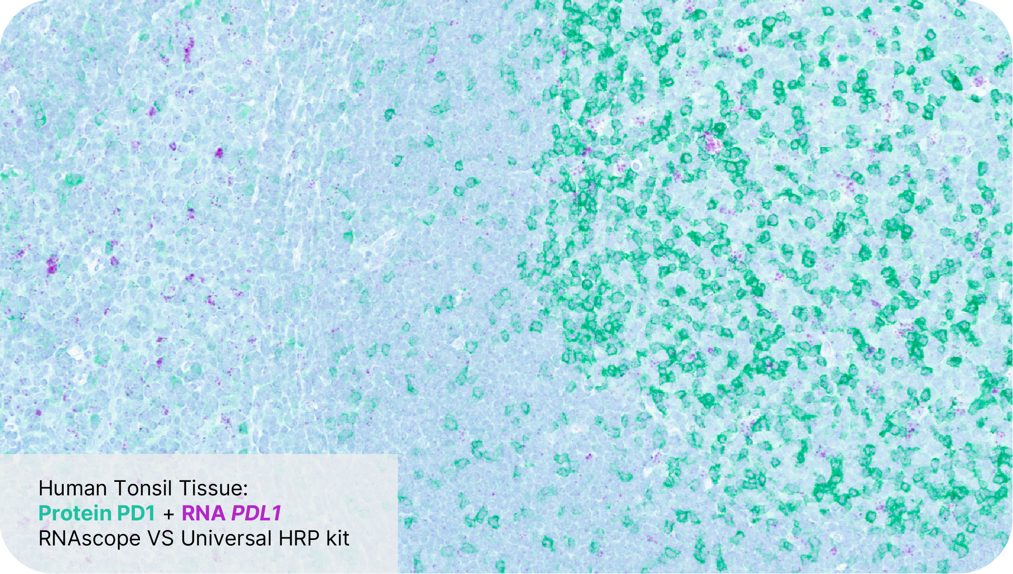 Protein PD1 + RNA PDL1 - RNAscope VS Universal HRP Assay