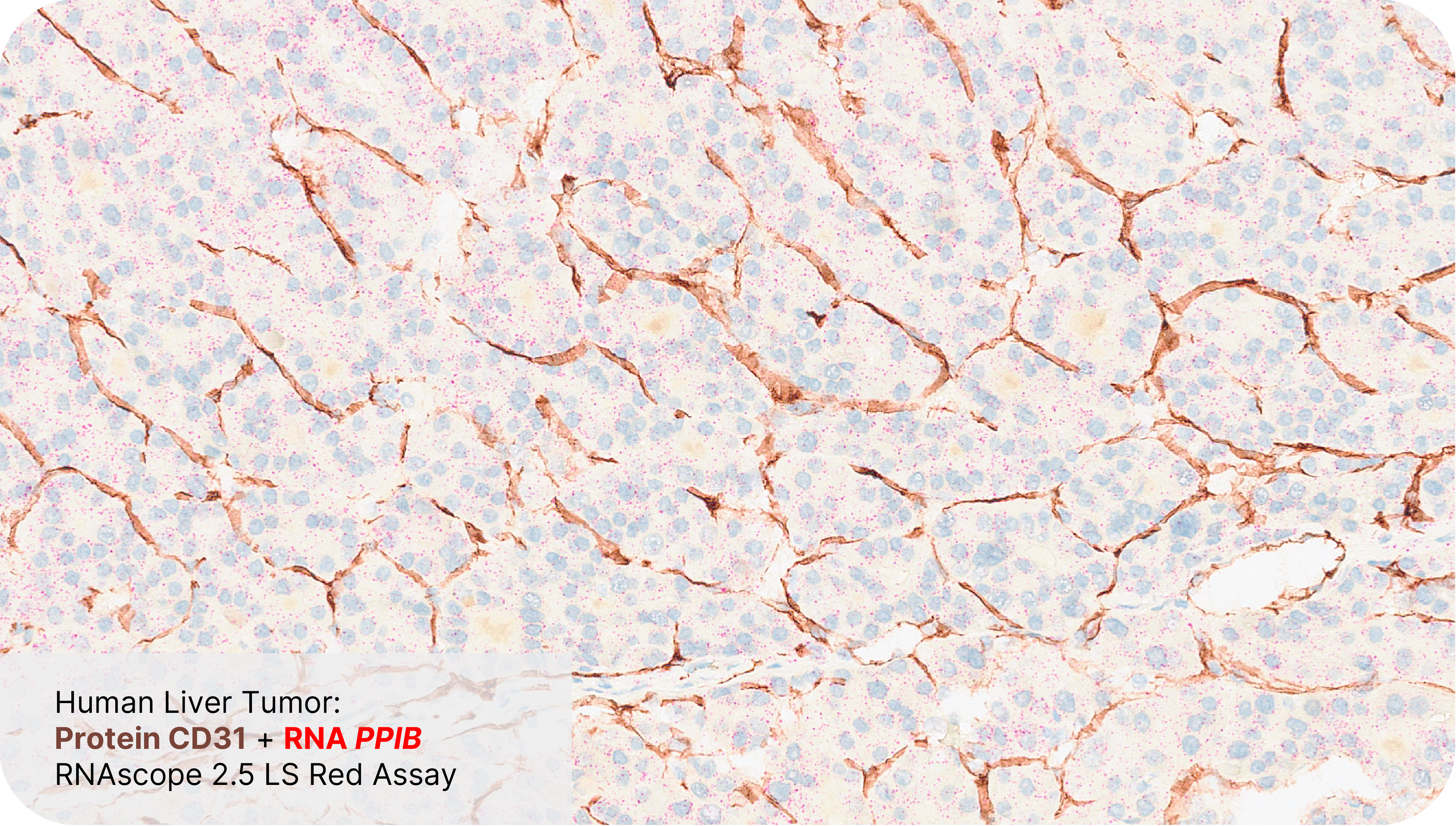 Protein CD31 + RNA PPIB - RNAscope 2.5 LS Red Assay