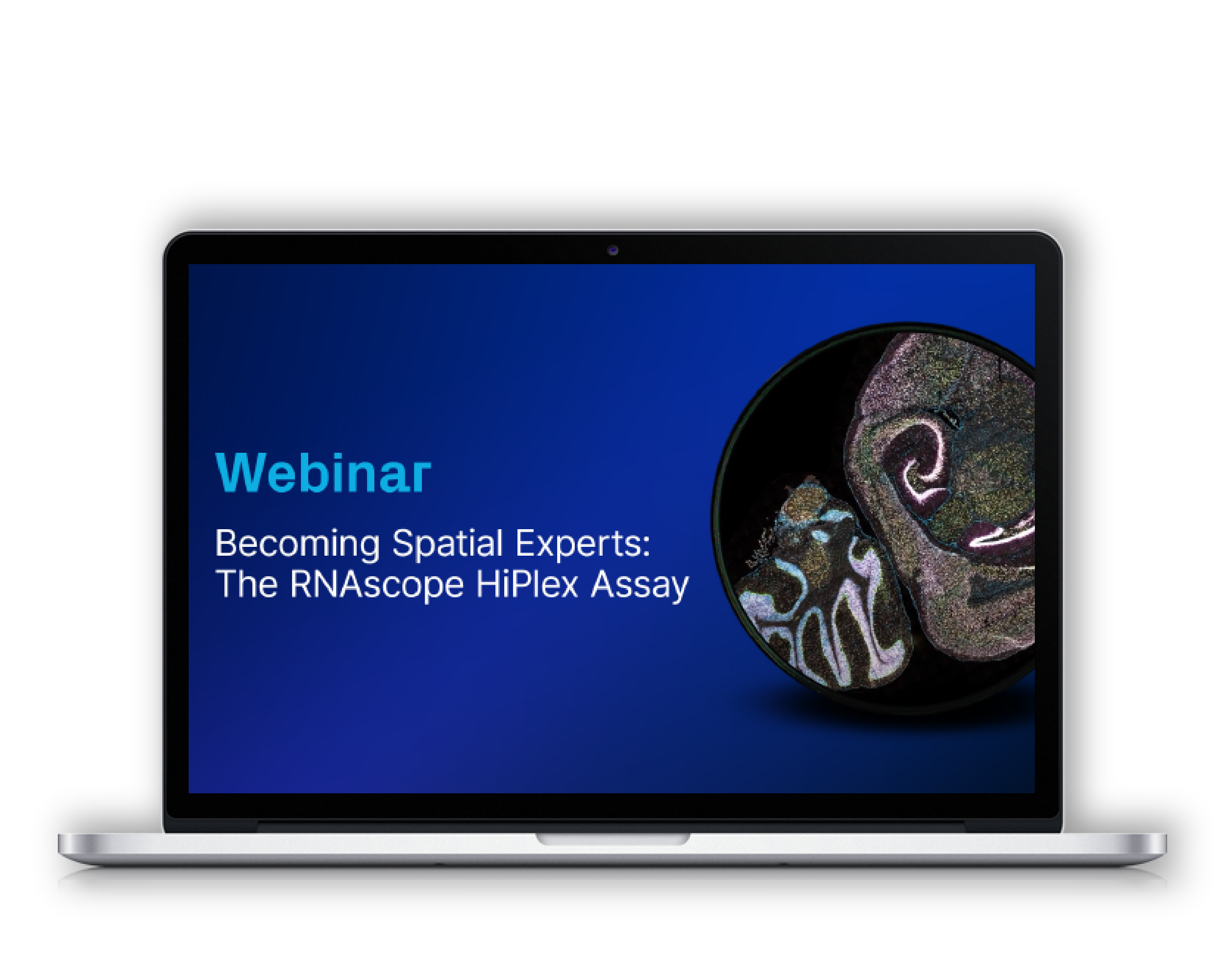 Becoming Spatial Experts: The RNAscope HiPlex Assay