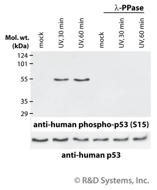 Phosphorylated p53 in CEM Cells.