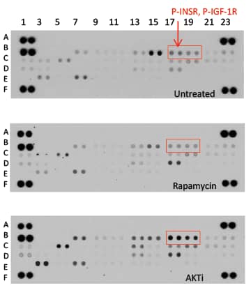 Proteome Profiler Phospho-RTK Antibody Arrays were Utilized to Investigate RTK Activation in Breast Cancer Cells