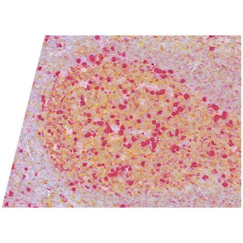 rnascope-cd20-lgk-red