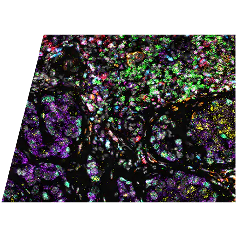 rnascope-hiplex-lung-cancer