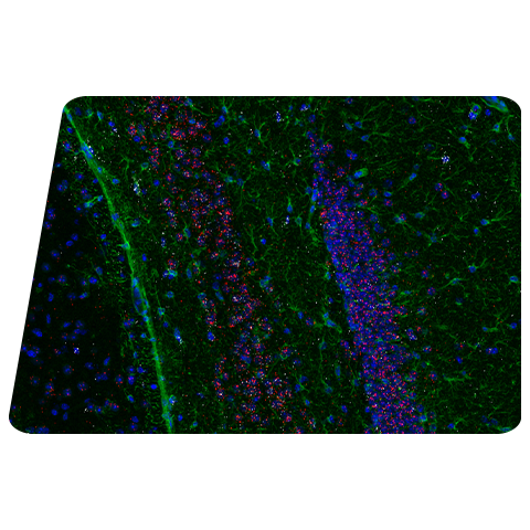 SBD hero foreground icwv2 ffmsbrain