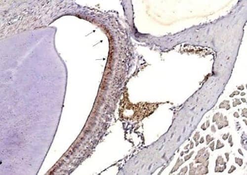 Immunohistochemical analysis showing Influenza A H3N2 Hemagglutinin detected  expression in mouse nasal tissue infected with Influenza A Virus using Rabbit anti-Influenza A H3N2 HA Polyclonal Antibody.