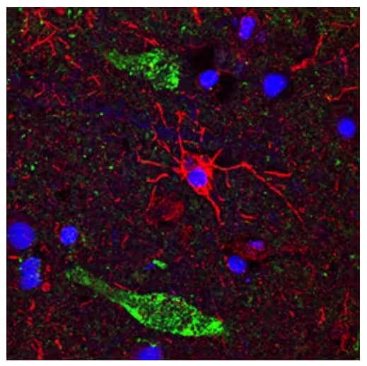 CD11b expression in microglia from human brain cerebral cortex, IHC