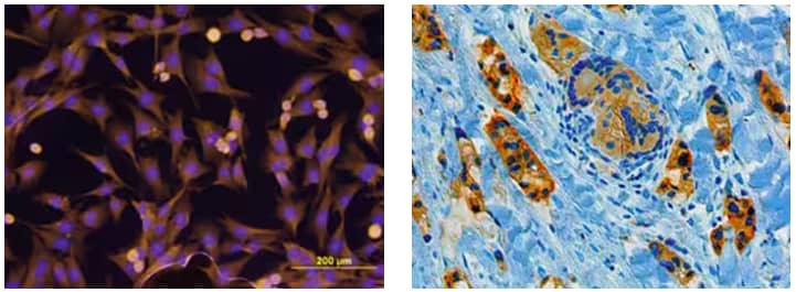 Immunocytochemical analysis of ErbB2/Her2 expression in MDA MB 231 human breast cancer cell line using Mouse anti-Human ErbB2/Her2 Monoclonal Antibody and staining with NL557-conjugated secondary antibody.