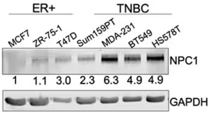 Western blot analysis showing lysates from ER+ and TNBC cell lines probed for NPC1, using Rabbit anti-Human NPC1 Polyclonal Antibody where results show increased expression in TNBC cell lines.