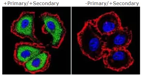 Primary and secondary antibody analysis ICC/IF
