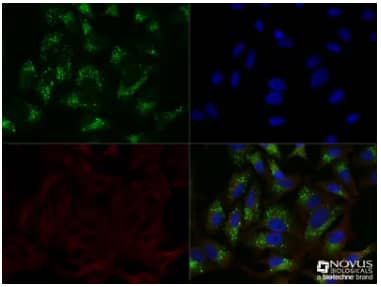 p62/SQSTM1 expression in HeLa cells treated with chloroquine, ICC