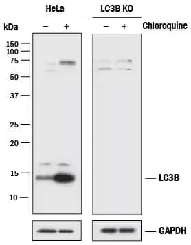 LC3B expression in HeLa cells, parental and LC3B KO, untreated or treated with Chloroquine, ICC