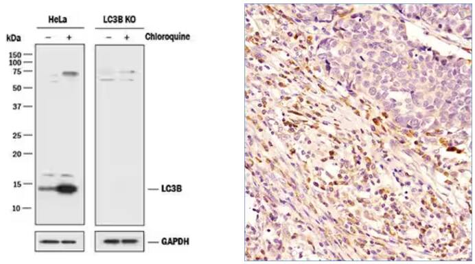 Western blot showing lysates from HeLa cell lines and LC3B knockout (KO) HeLa cell lines, both chloroquine treated and untreated, probed with rabbit monoclonal LC3B antibody and followed by HRP-conjugated secondary antibody.