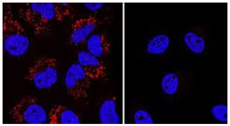 Immunocytochemical staining of immersion-fixed chloroquine treated control and LC3B-knockout HeLa cells probed with rabbit polyclonal LC3B-antibody and anti-rabbit secondary antibody (red) and counterstained with DAPI (blue).