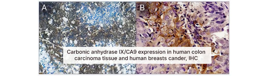 Carbonic anhydrase IX/CA9 expression serves as a marker for hypoxia. Expression of Carbonic anhydrase IX/CA9 is regulated by HIFs and is commonly increased in cancer tissues (e.g., colon and breast carcinoma)