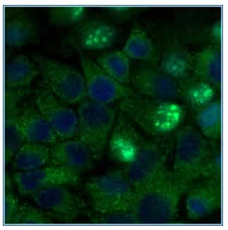 ATG5 expression in HeLa cells, ICC, Immunofluorescence, visualized with anti-rabbit Dylight and stained with DAPI