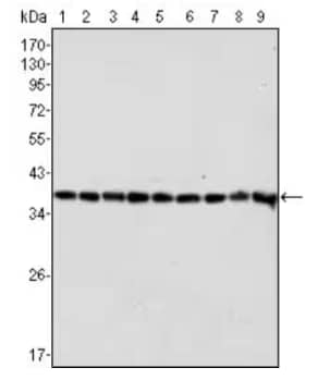 Western Blot of GAPDH Loading Control