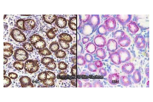 FFPE sections of human stomach showing detection of CA9 mRNA using a probe and Fast Red chromogen as well as an adjacent section probed for CA9 protein using Rabbit anti-CA9 Polyclonal Antibody, stained with DAB chromogen, and nuclei counterstained with D