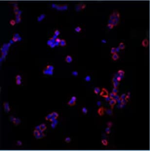 CD11b expression in human peripheral blood mononuclear cells ICC