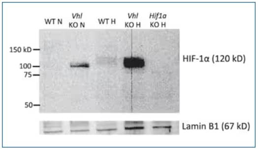 HIF-1 alpha expression in CD4+ T cells from wildtype, VHL-knockout and HIF-knockout mice under normoxic and hypoxic conditions. Lamin B1 used as loading control, Western Blot