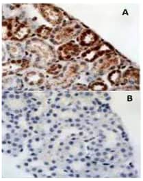 HIF-1 alpha antibody