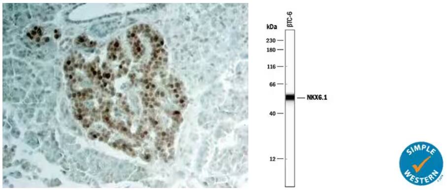 Immunohistochemical analysis of paraffin-embedded human pancreas tissue probed with anti-NKX6.1 antibody, followed by HRP-DAB staining kit, and counterstained with hematoxylin.