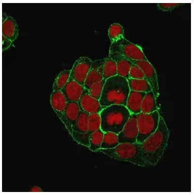 Immunofluorescent staining of breast cancer MCF-7 cell line using mouse monoclonal Glut1 antibody which was detected by secondary antibody (green) and co-stained for nuclei with Red Dot (red).