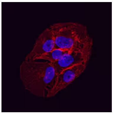 Immunocytochemical/Immunofluorescent staining of HepG2 hepatocellular carcinoma cells using mouse monoclonal Glut1 antibody and detected using secondary antibody (red) and co-stained with nuclear stain DAPI (blue).