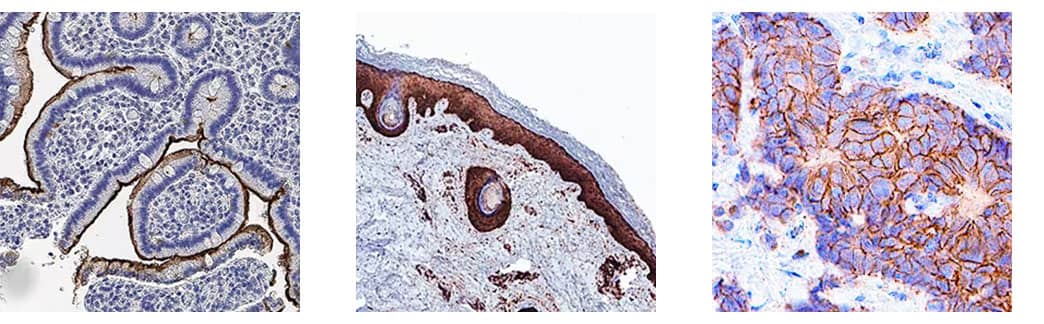 Immunohistochemical analysis showing MEP1B expression detected in human duodenum using Goat Anti-Human MEP1B Polyclonal Antibody and Anti-Goat VisUCyte Detection Kit. Tissue was stained with DAB (brown) and counterstained with hematoxylin (blue). 