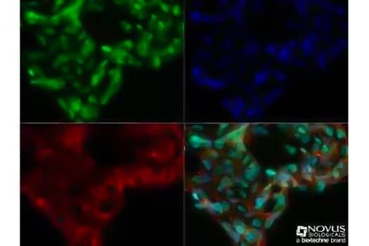 Immunocytochemical analysis showing DNMT3A expression in formalin-fixed Ntera2 cells using Mouse Anti-DNMT3 Monoclonal Antibody and detected using Anti-Mouse DyLight 488 secondary antibody (green). Actin was detected with Phalloidin 568 (red), and nuclei 