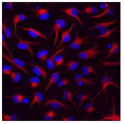 Vimentin antibody