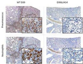 Histopathological analysis of lung sections collected at 24 hr post-bacterial infection from mice co-infected with mouse-adapted Influenza A and Type 2 Pneumococcal strain D39 variants.