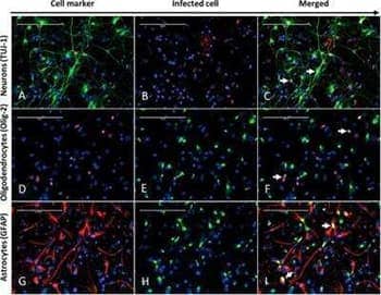 Immunofluorescent analysis of Newcastle Disease Virus antibody expression and cell markers in infected chicken neural cells