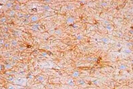 Immunohistochemical analysis of GFAP antibody expression in human brain with DAB staining (brown) and counterstaining with hematoxylin (blue).