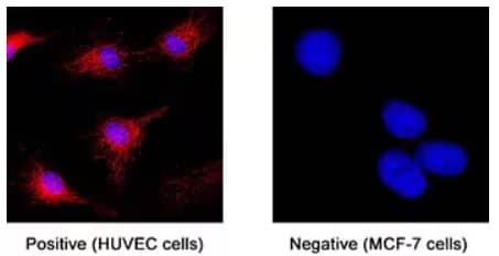 Immunocytochemical analysis showing ST2/IL-33R expression in immersion-fixed HUVEC cells (positive staining) and MCF-7 cells (negative staining) in using Llama Anti-ST2/Il-33R LlamabodyTM Bivalent VHH HuIgG2 Fusion Monoclonal Antibody followed by secondar