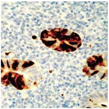 Adenovirus antibody